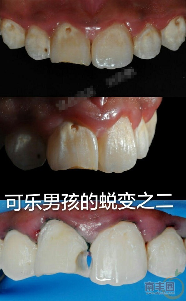 a37dc983gw1f2m1kmv2qwj20go17gjut.jpg