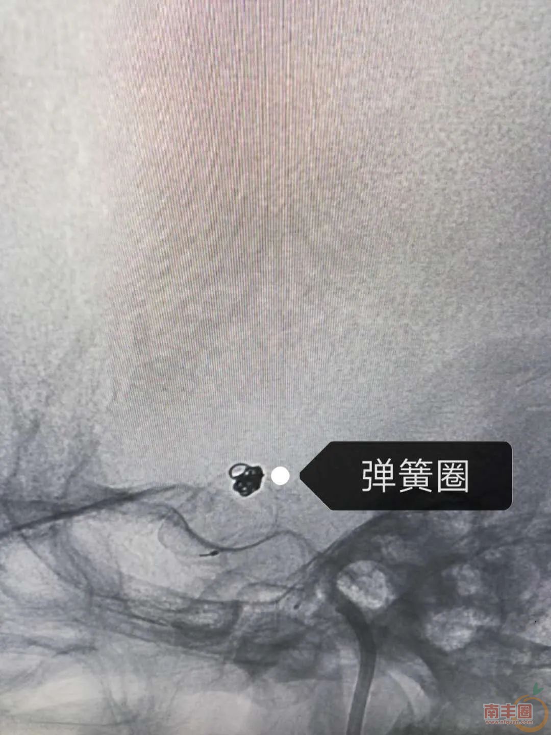 174825nn24a74gj6ze6i19.jpg